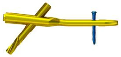 MR-IM Tibial Nail