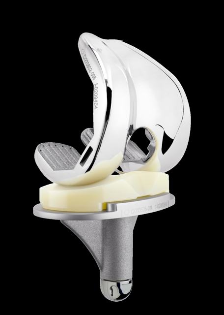 Knee replacement implant